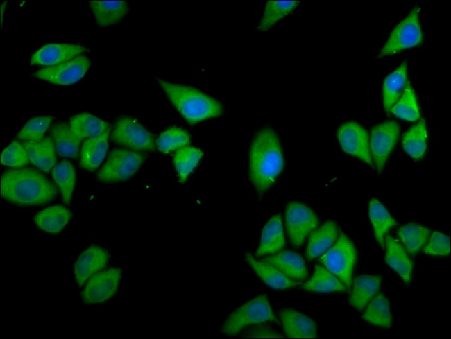 CLCC1 Antibody in Immunocytochemistry (ICC/IF)