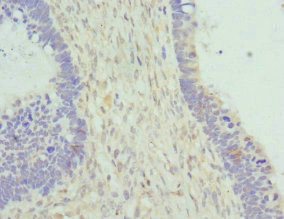 Cytohesin 2 Antibody in Immunohistochemistry (Paraffin) (IHC (P))