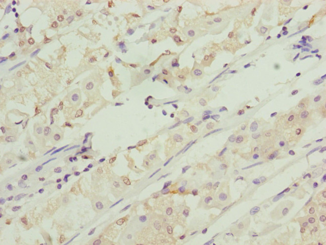 RNF5 Antibody in Immunohistochemistry (Paraffin) (IHC (P))