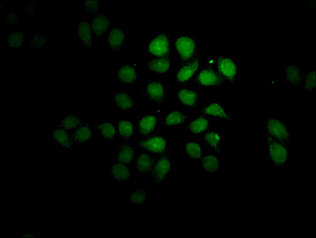 FEV Antibody in Immunocytochemistry (ICC/IF)