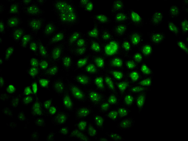 TSNAX Antibody in Immunocytochemistry (ICC/IF)