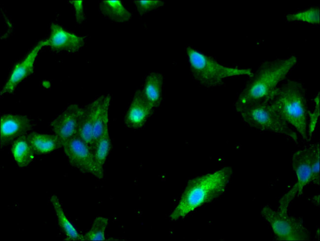 PAIP2 Antibody in Immunocytochemistry (ICC/IF)
