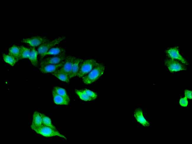 STAC Antibody in Immunocytochemistry (ICC/IF)