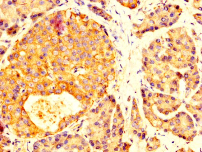 MYOC Antibody in Immunohistochemistry (Paraffin) (IHC (P))