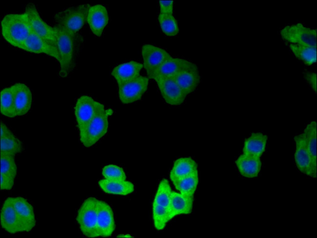 Calponin 2 Antibody in Immunocytochemistry (ICC/IF)