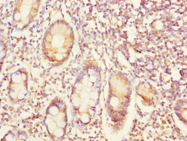 EYA3 Antibody in Immunohistochemistry (Paraffin) (IHC (P))