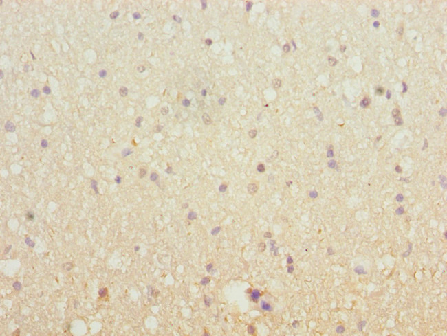 SH3GL2 Antibody in Immunohistochemistry (Paraffin) (IHC (P))