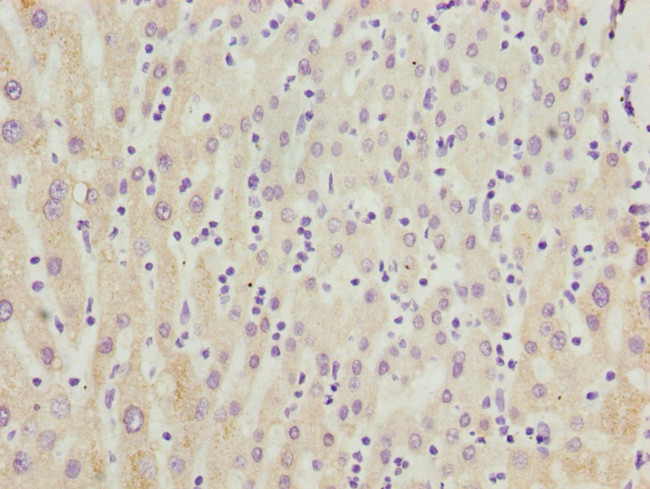 CYP3A43 Antibody in Immunohistochemistry (Paraffin) (IHC (P))