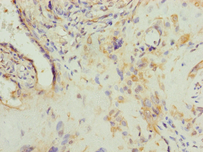 AP1M1 Antibody in Immunohistochemistry (Paraffin) (IHC (P))