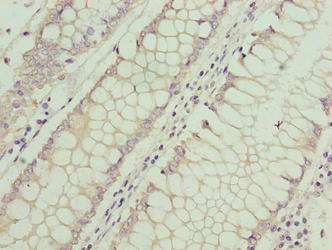 ASB7 Antibody in Immunohistochemistry (Paraffin) (IHC (P))