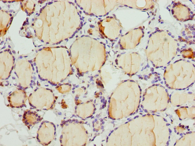 TAPP1 Antibody in Immunohistochemistry (Paraffin) (IHC (P))