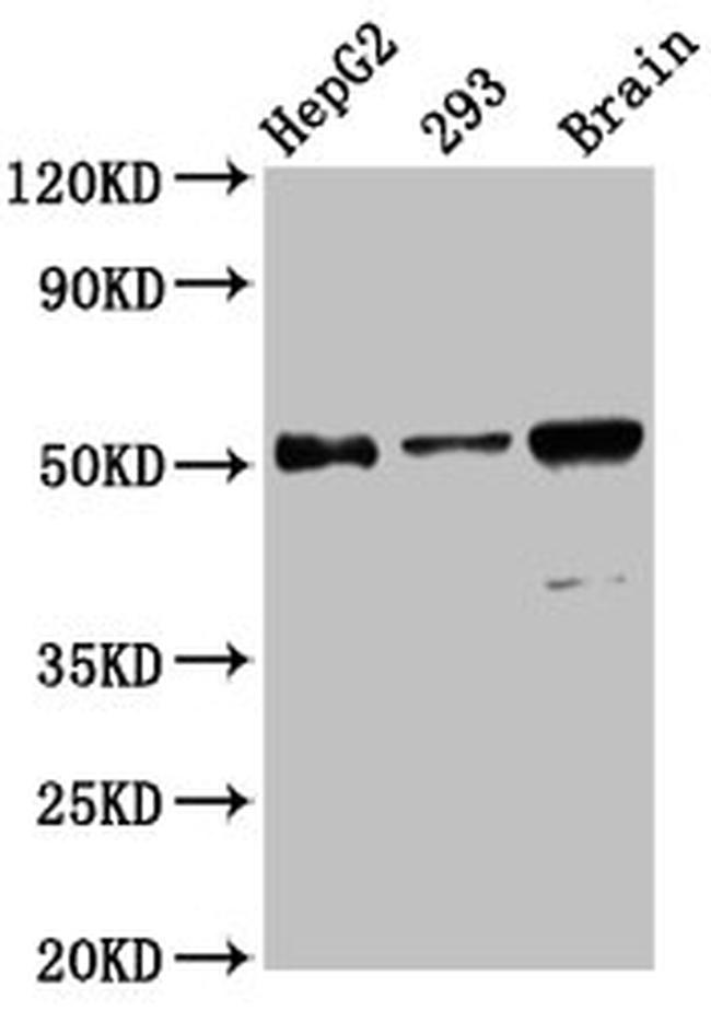ZFP57 Antibody in Western Blot (WB)
