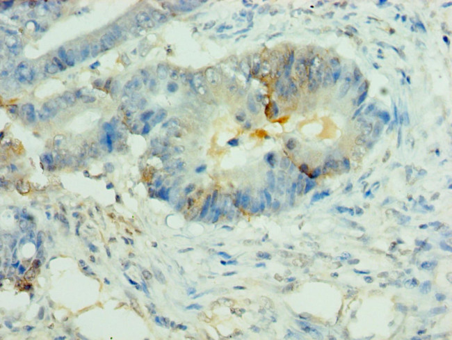 NALP2 Antibody in Immunohistochemistry (Paraffin) (IHC (P))