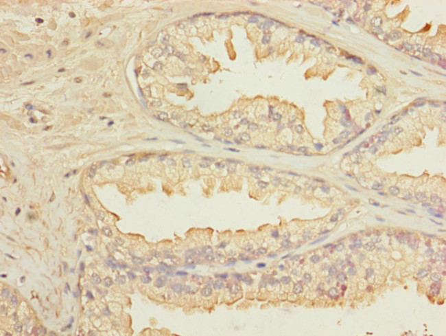 KLHL13 Antibody in Immunohistochemistry (Paraffin) (IHC (P))