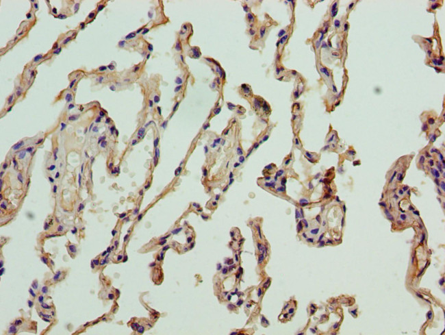 NICN1 Antibody in Immunohistochemistry (Paraffin) (IHC (P))