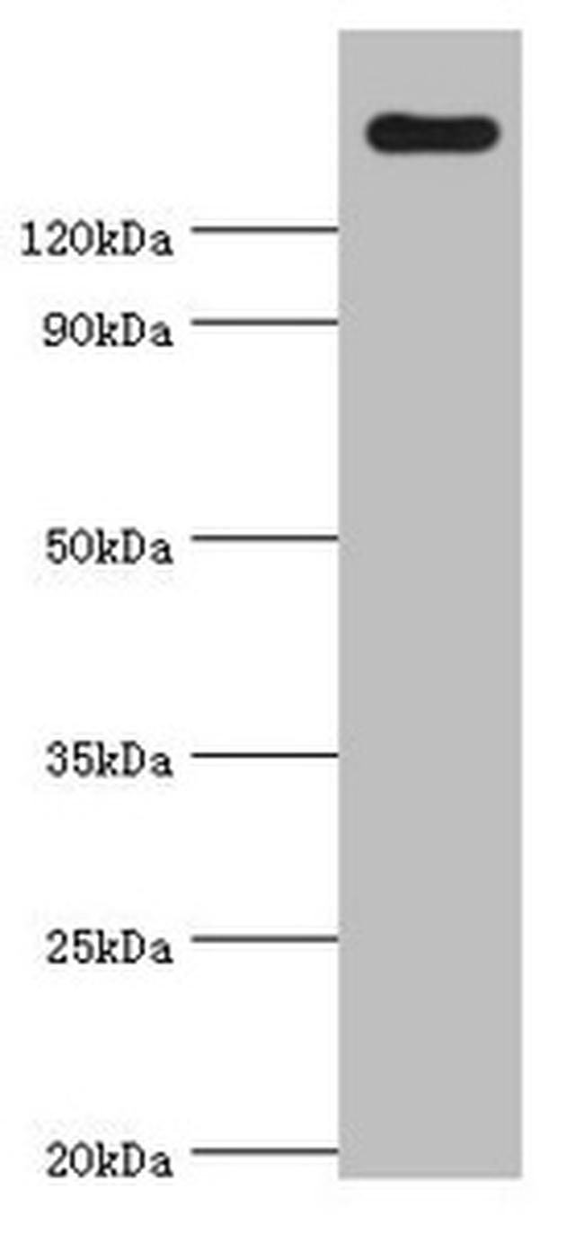 CARD11 Antibody in Western Blot (WB)