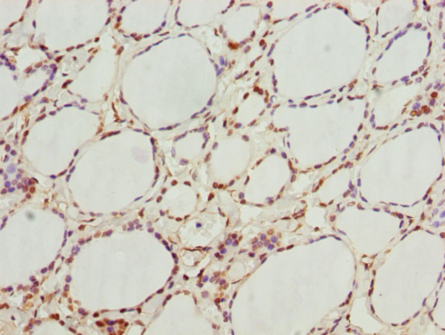 GNB1L Antibody in Immunohistochemistry (Paraffin) (IHC (P))