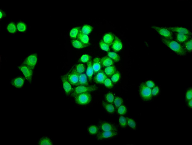 SHARPIN Antibody in Immunocytochemistry (ICC/IF)