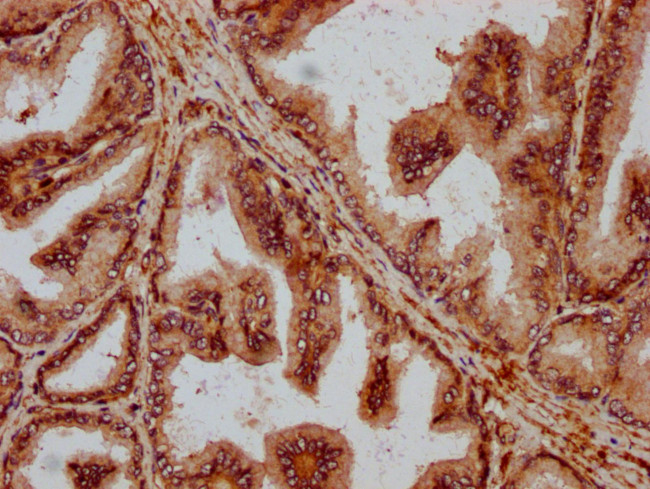 PPA2 Antibody in Immunohistochemistry (Paraffin) (IHC (P))