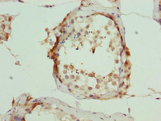 C6orf211 Antibody in Immunohistochemistry (Paraffin) (IHC (P))