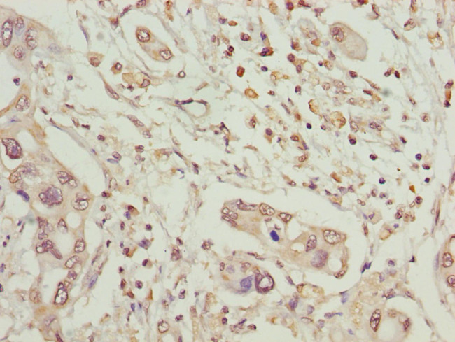 MCCC2 Antibody in Immunohistochemistry (Paraffin) (IHC (P))