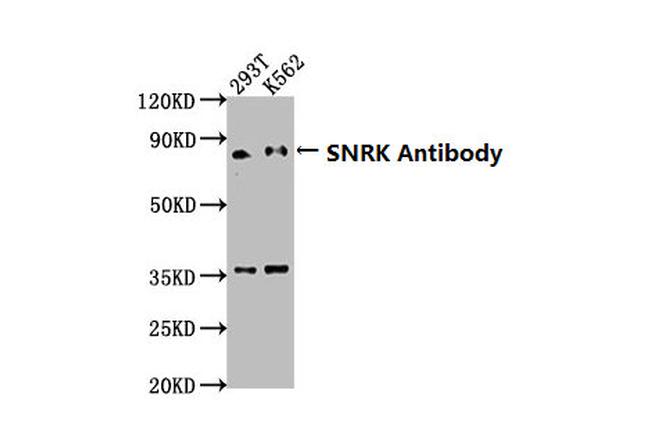 SNRK Antibody in Western Blot (WB)