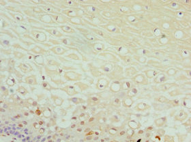DPP3 Antibody in Immunohistochemistry (Paraffin) (IHC (P))