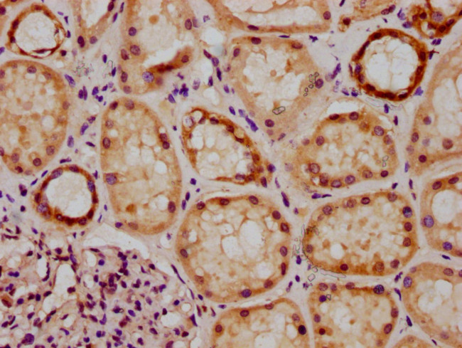 GRHL1 Antibody in Immunohistochemistry (Paraffin) (IHC (P))