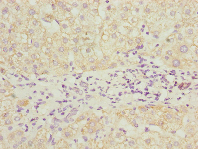 PDCD2L Antibody in Immunohistochemistry (Paraffin) (IHC (P))