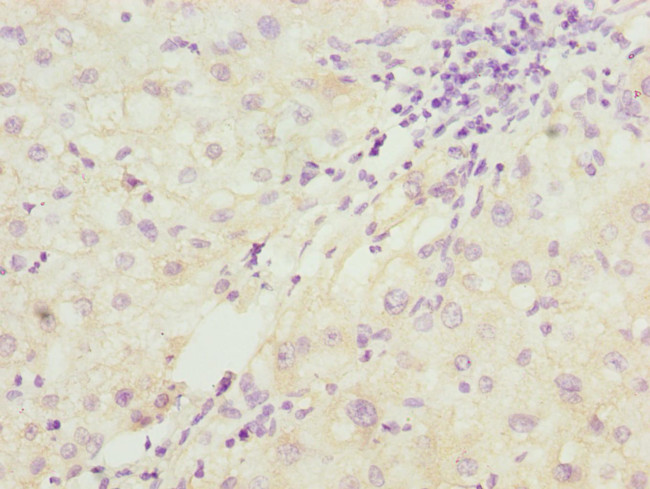 PDCD2L Antibody in Immunohistochemistry (Paraffin) (IHC (P))