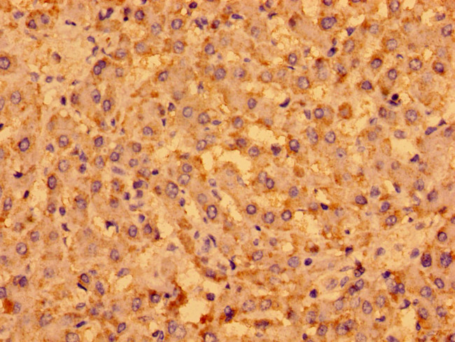 MENT Antibody in Immunohistochemistry (Paraffin) (IHC (P))