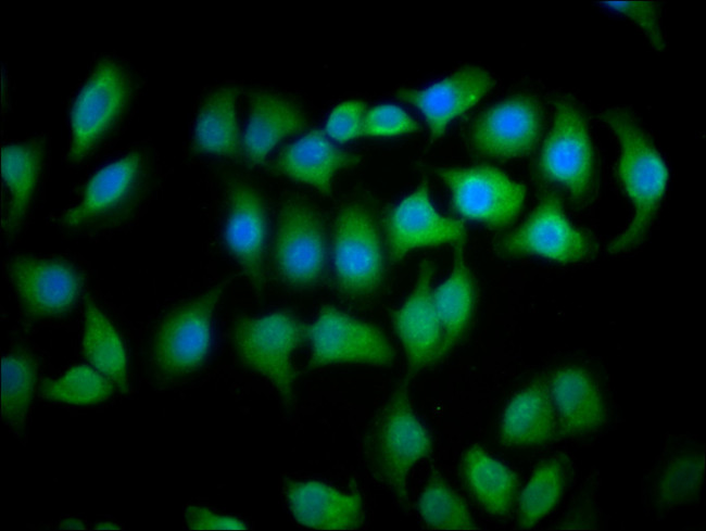MOB1 Antibody in Immunocytochemistry (ICC/IF)