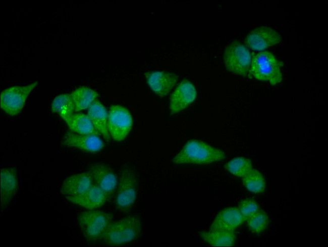 MYOZ2 Antibody in Immunocytochemistry (ICC/IF)