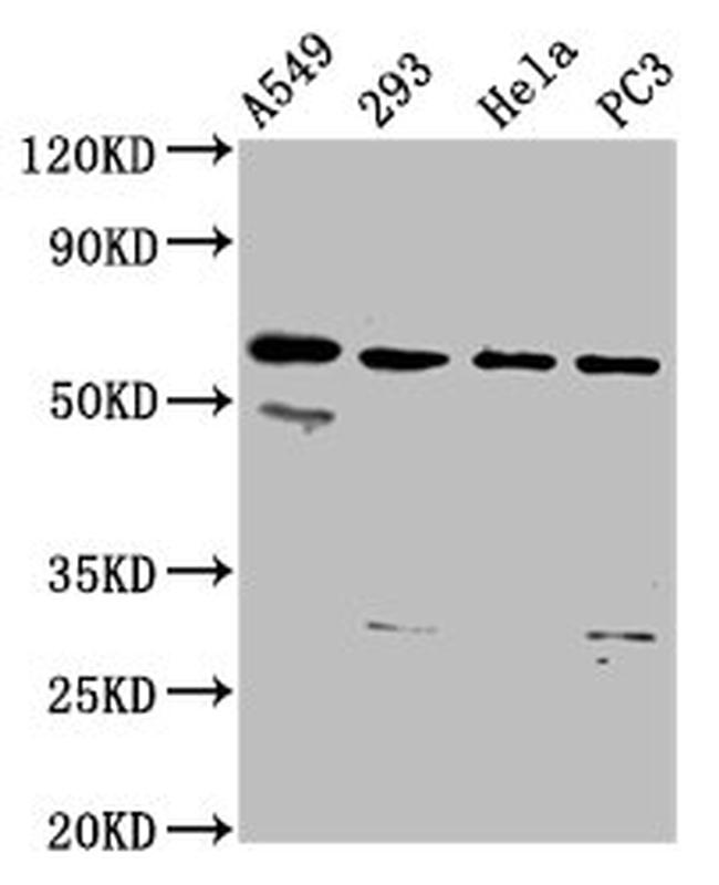 DDX28 Antibody in Western Blot (WB)
