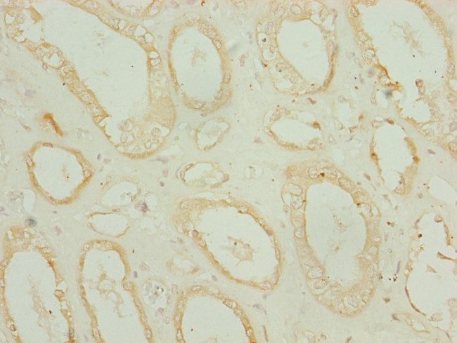 CHCHD3 Antibody in Immunohistochemistry (Paraffin) (IHC (P))