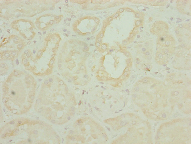 CHCHD3 Antibody in Immunohistochemistry (Paraffin) (IHC (P))
