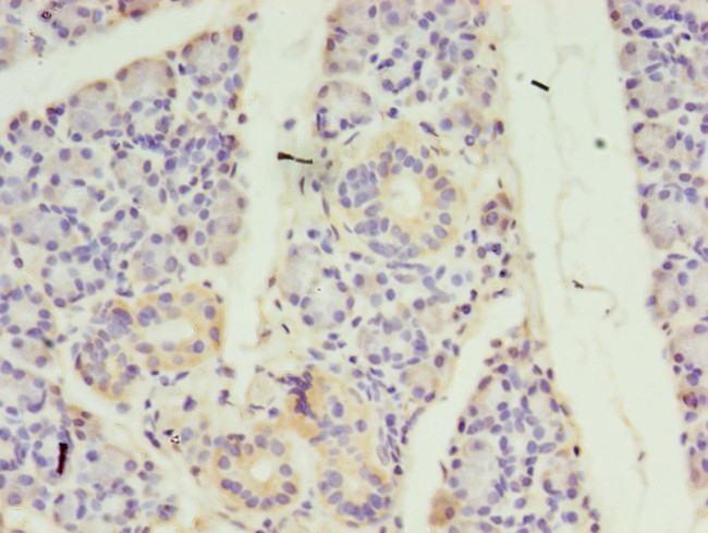 ALS2CR2 Antibody in Immunohistochemistry (Paraffin) (IHC (P))