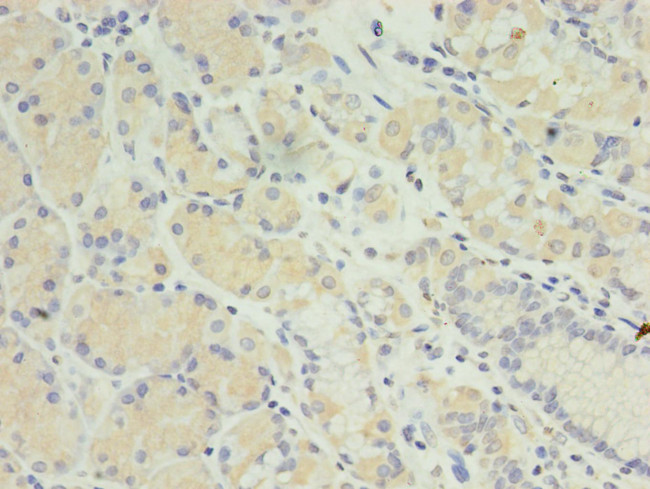 MIS12 Antibody in Immunohistochemistry (Paraffin) (IHC (P))