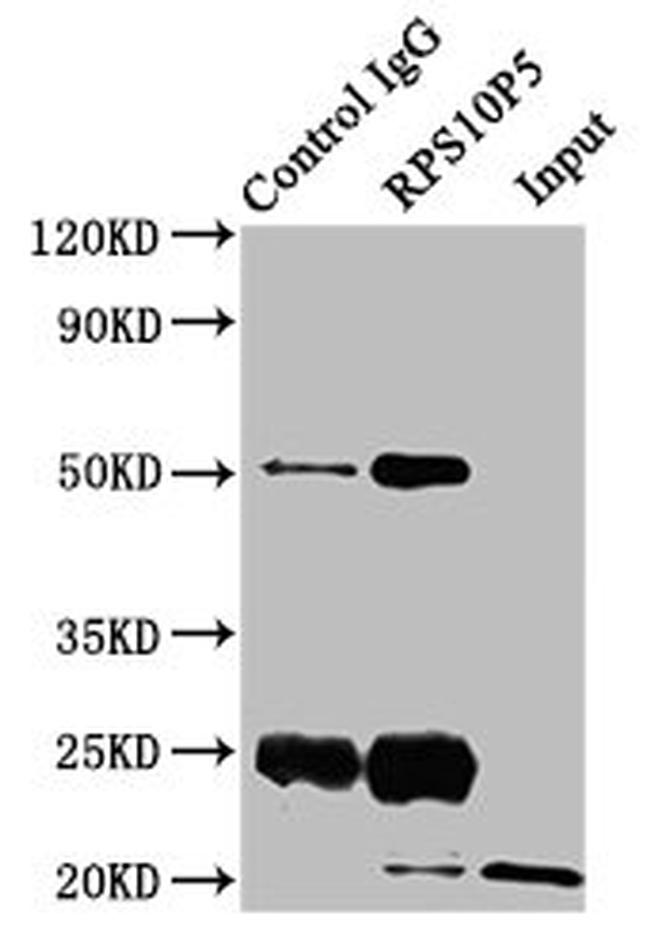 RPS10P5 Antibody in Western Blot (WB)