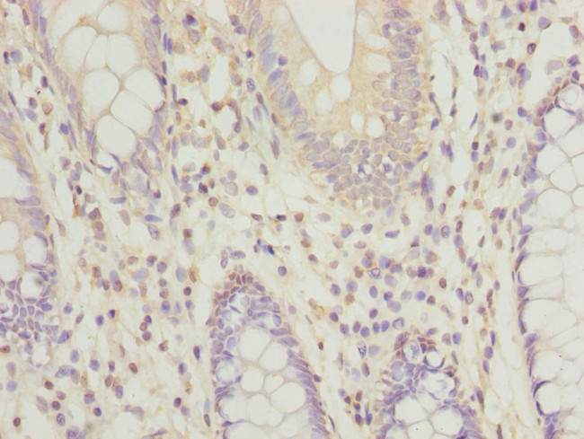 RPRD1B Antibody in Immunohistochemistry (Paraffin) (IHC (P))