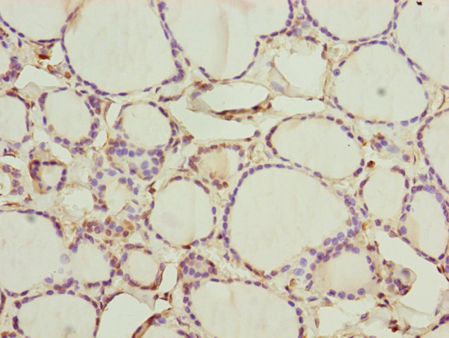 CEP44 Antibody in Immunohistochemistry (Paraffin) (IHC (P))