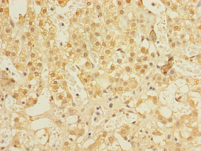 ALS2CR1 Antibody in Immunohistochemistry (Paraffin) (IHC (P))