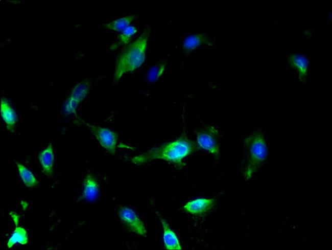 SLC25A18 Antibody in Immunocytochemistry (ICC/IF)