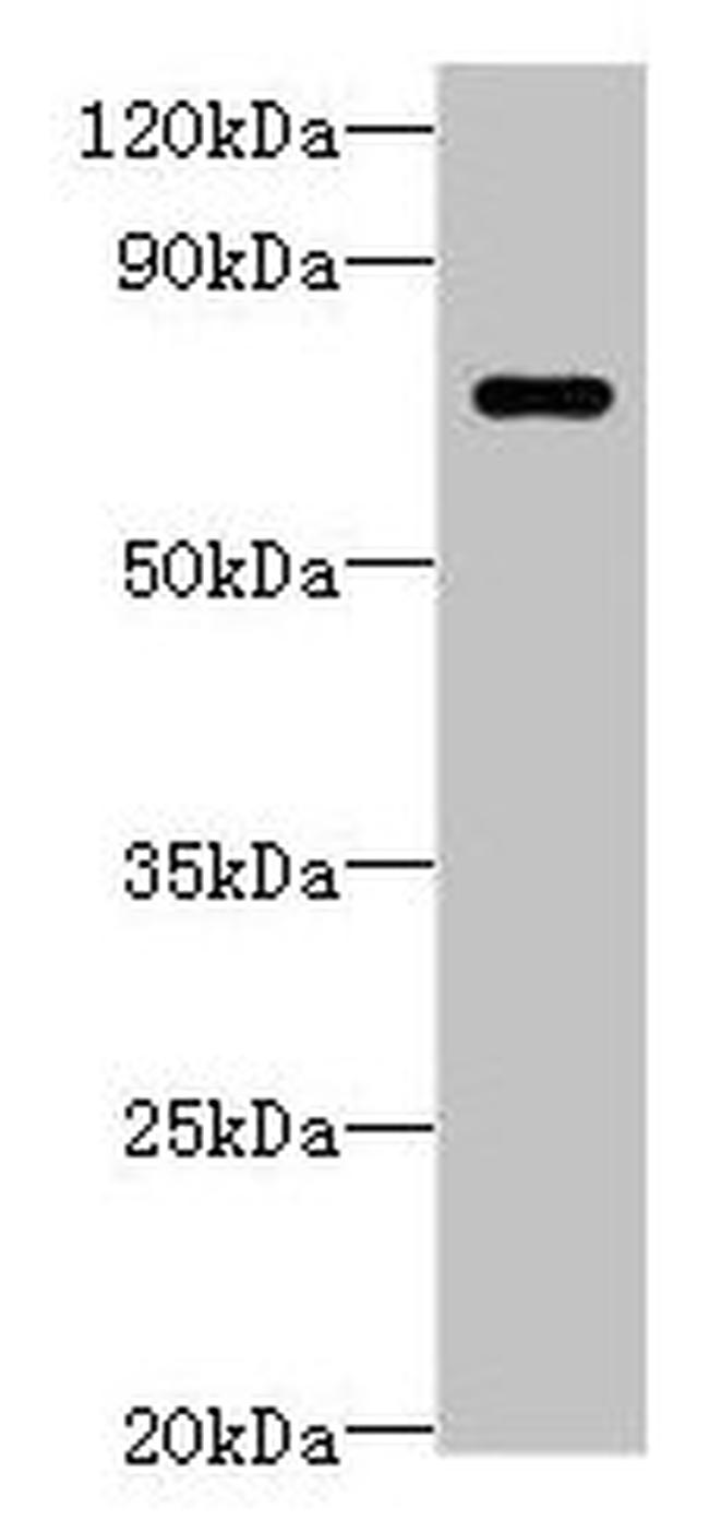 LRRC40 Antibody in Western Blot (WB)