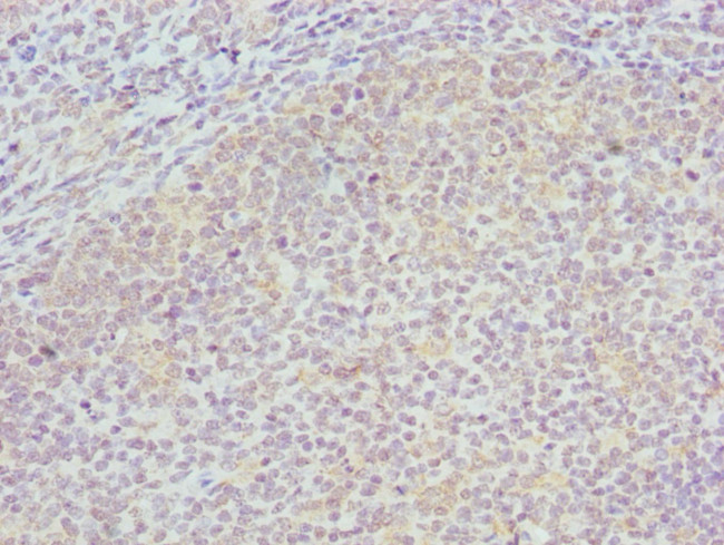 COG4 Antibody in Immunohistochemistry (Paraffin) (IHC (P))