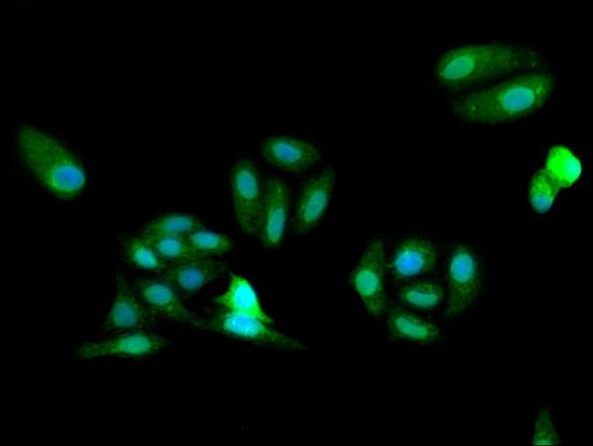 FARSB Antibody in Immunocytochemistry (ICC/IF)