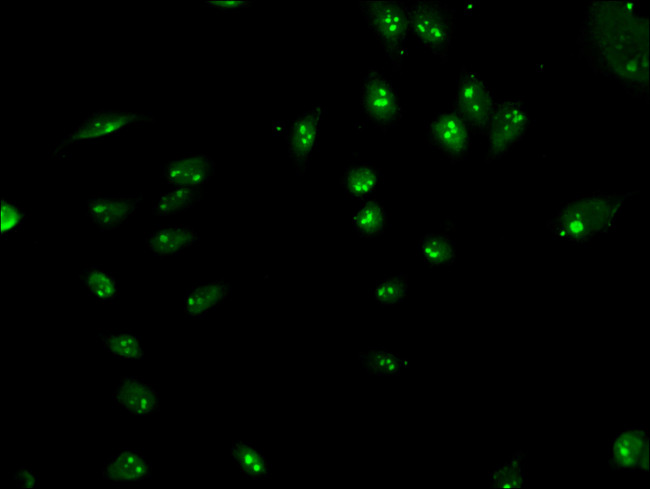 LYAR Antibody in Immunocytochemistry (ICC/IF)