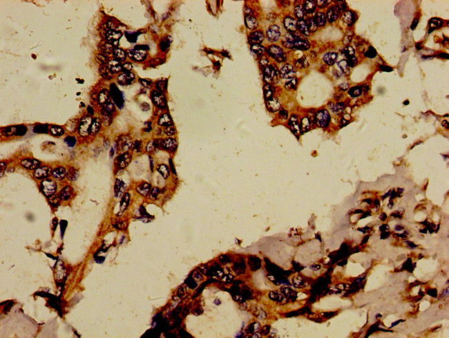 RBPJL Antibody in Immunohistochemistry (Paraffin) (IHC (P))