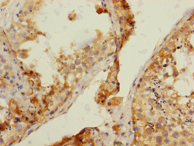 NRBP Antibody in Immunohistochemistry (Paraffin) (IHC (P))