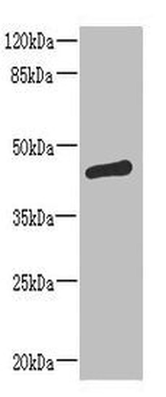 ST6GALNAC2 Antibody in Western Blot (WB)